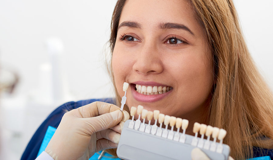 Porcelain Dental Veneers